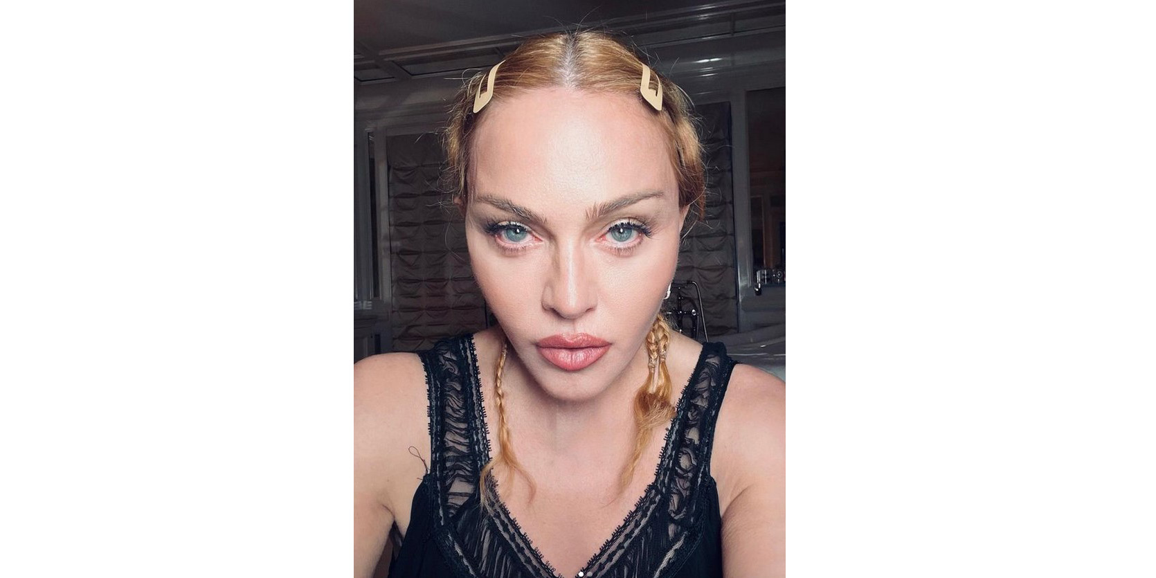 Madonna suspende gira mundial tras hospitalización en terapia intensiva madonna