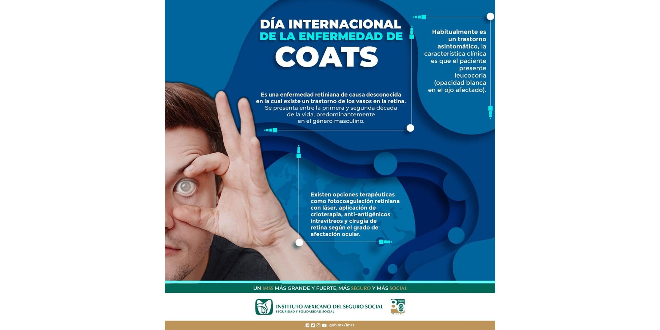Informa IMSS Veracruz Sur sobre enfermedad de Coats Coats