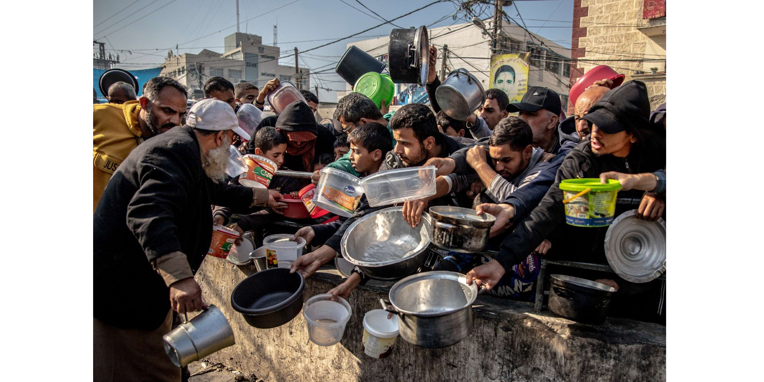La combinación letal de hambre y enfermedades provocará más muertes en Gaza hambruna