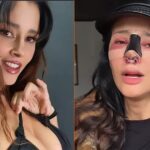 La modelo Dorismar reaparece con el rostro desfigurado