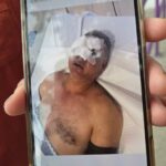 Por fractura de rostro más de un mes estará celayense agredido por porra de Racing en Boca del Río